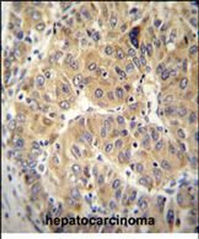 NARS Antibody in Immunohistochemistry (Paraffin) (IHC (P))