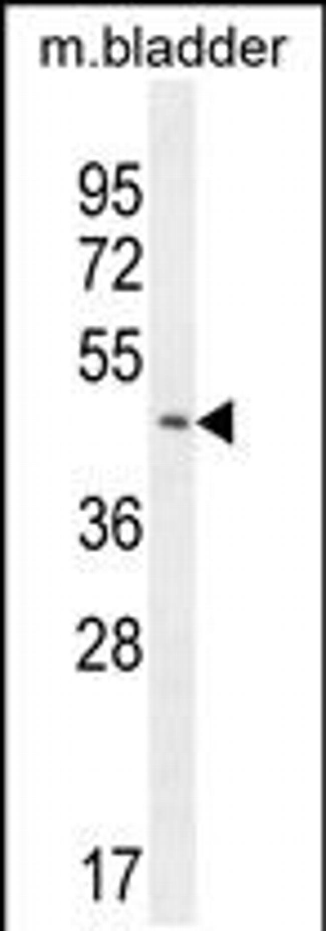 PARS2 Antibody in Western Blot (WB)