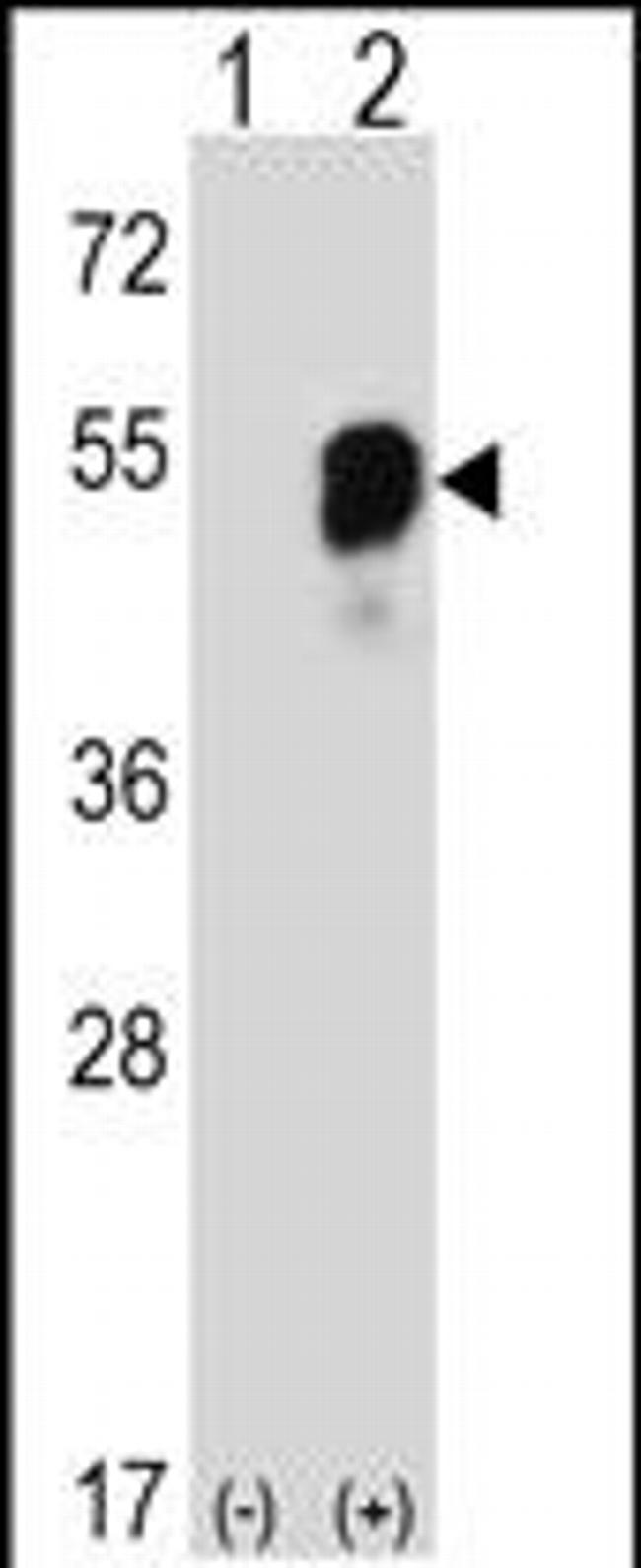 PARS2 Antibody in Western Blot (WB)