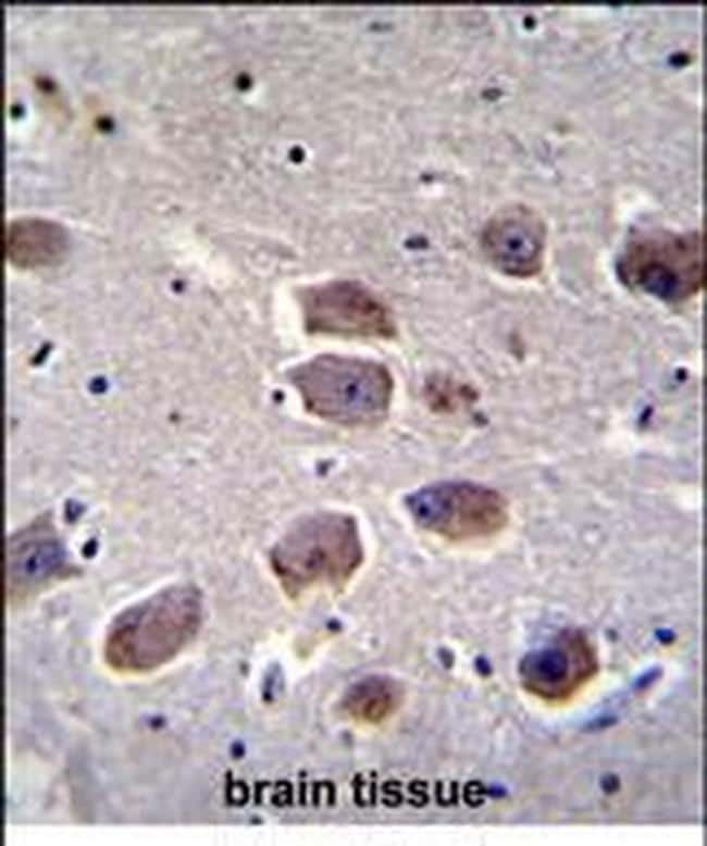 NAA30 Antibody in Immunohistochemistry (Paraffin) (IHC (P))