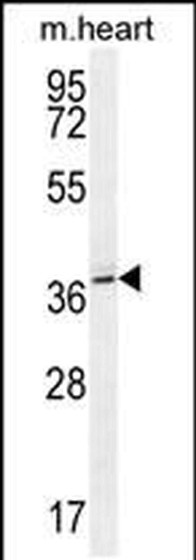 NAA30 Antibody in Western Blot (WB)