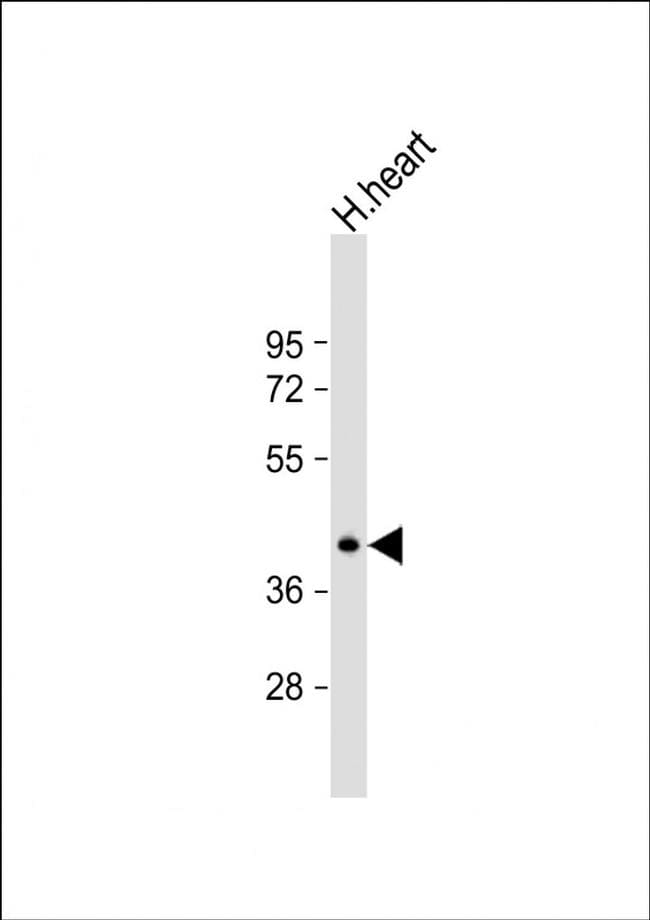 NAA30 Antibody in Western Blot (WB)