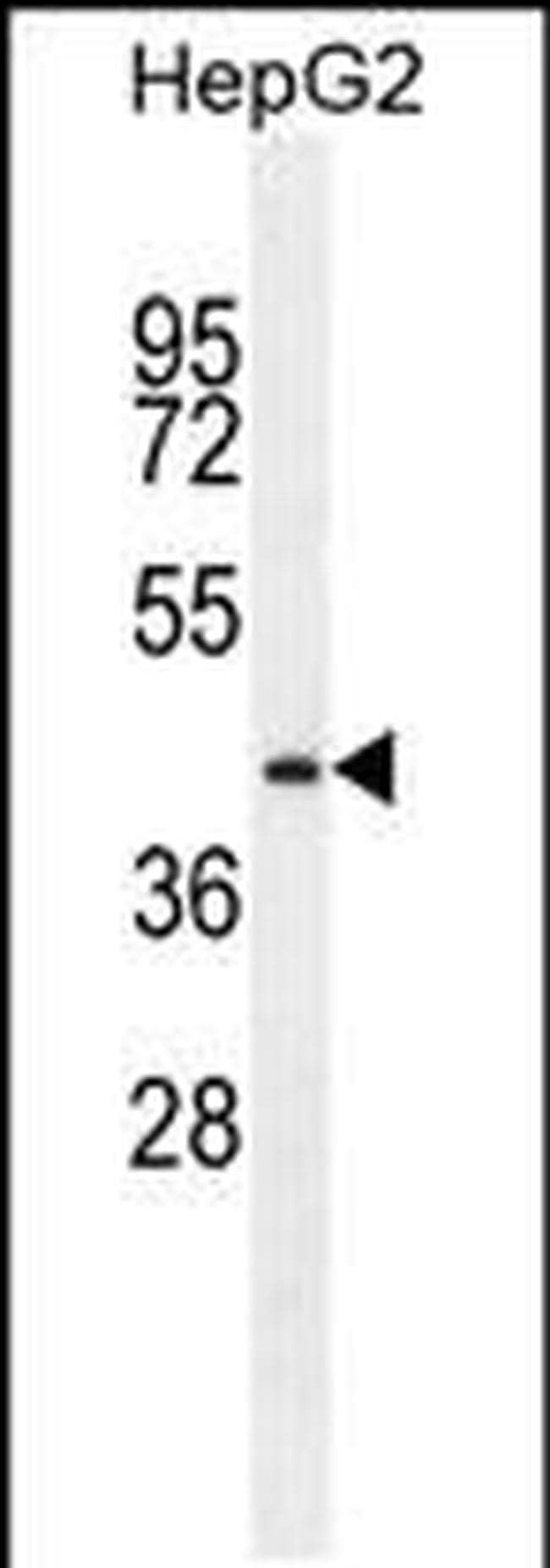 PRRT1 Antibody in Western Blot (WB)