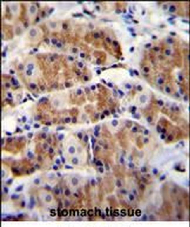 POLR3GL Antibody in Immunohistochemistry (Paraffin) (IHC (P))