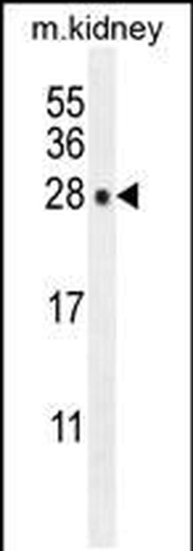 POLR3GL Antibody in Western Blot (WB)