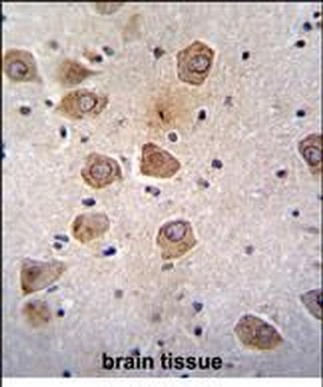 CLVS2 Antibody in Immunohistochemistry (Paraffin) (IHC (P))