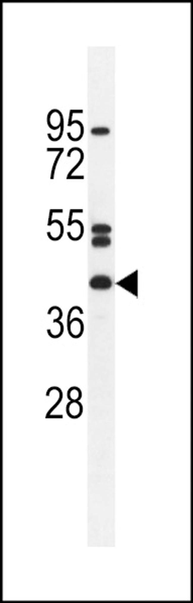 NT5DC4 Antibody in Western Blot (WB)