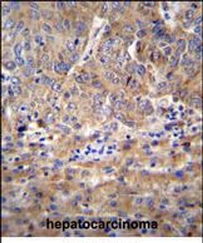 DIEXF Antibody in Immunohistochemistry (Paraffin) (IHC (P))