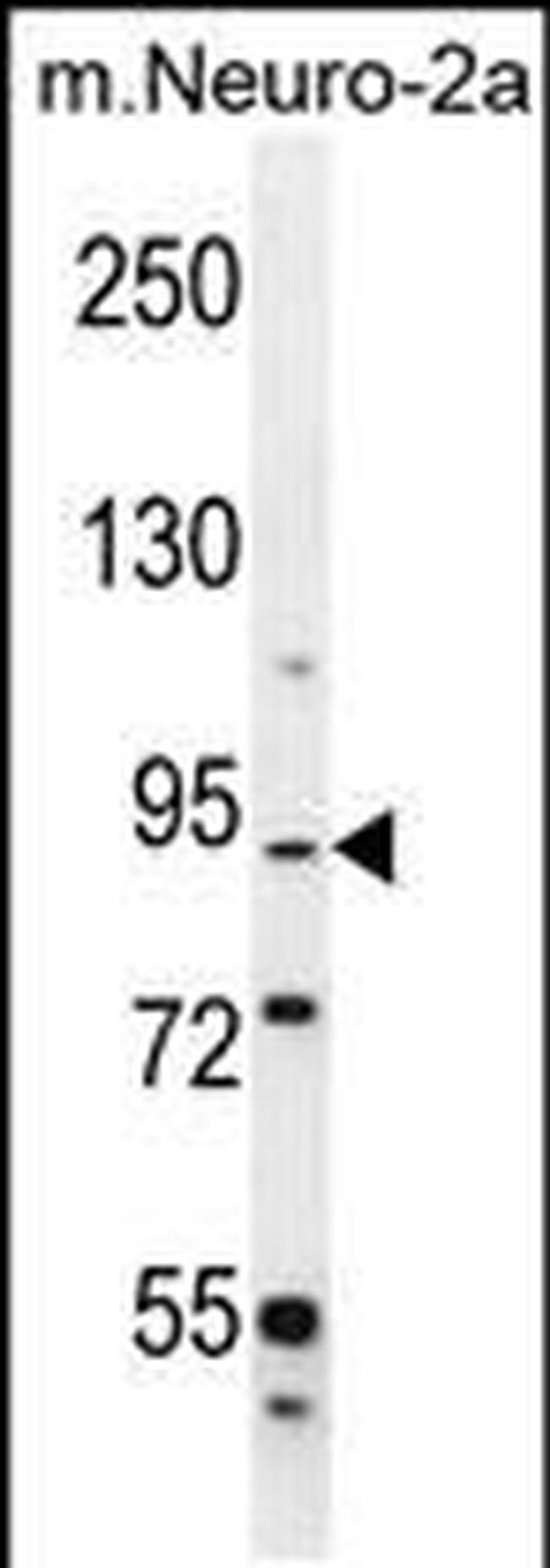 DIEXF Antibody in Western Blot (WB)