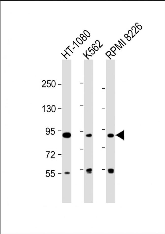 DIEXF Antibody in Western Blot (WB)