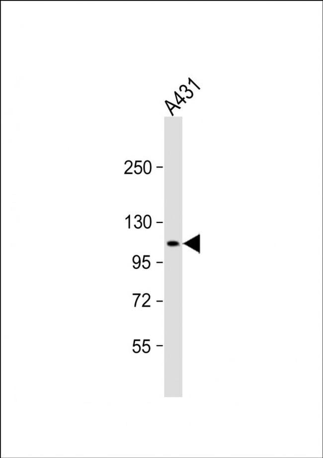 DIEXF Antibody in Western Blot (WB)