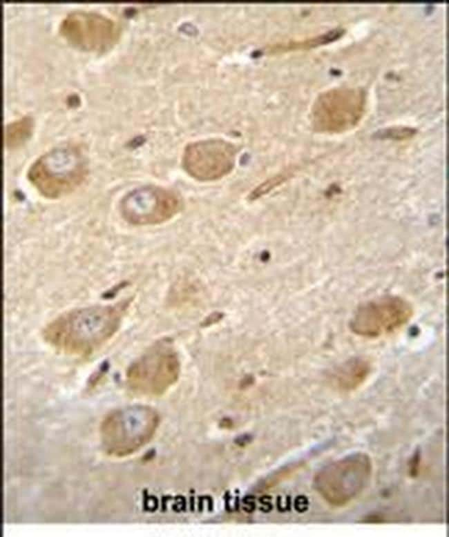 CNGA4 Antibody in Immunohistochemistry (Paraffin) (IHC (P))