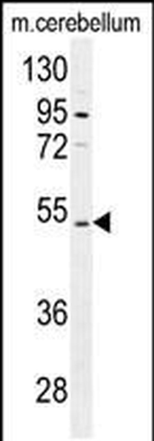 CNGA4 Antibody in Western Blot (WB)