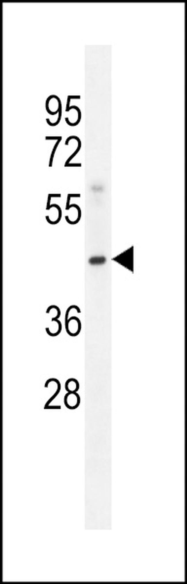 MOGAT3 Antibody in Western Blot (WB)