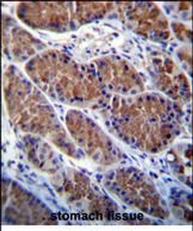 OTOP1 Antibody in Immunohistochemistry (Paraffin) (IHC (P))