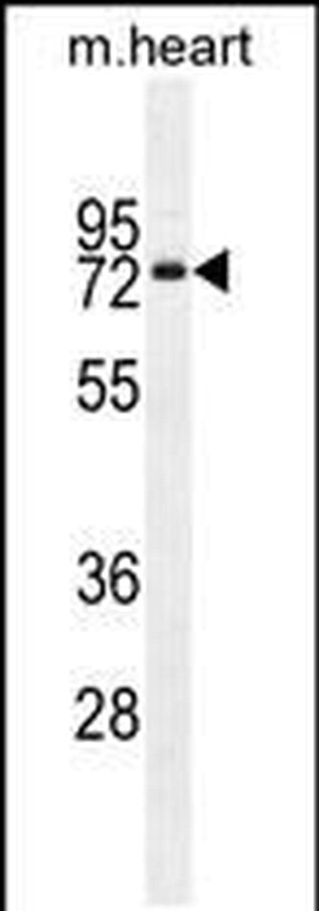 OTOP1 Antibody in Western Blot (WB)