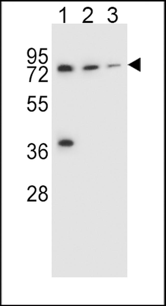 UGT2B15 Antibody in Western Blot (WB)