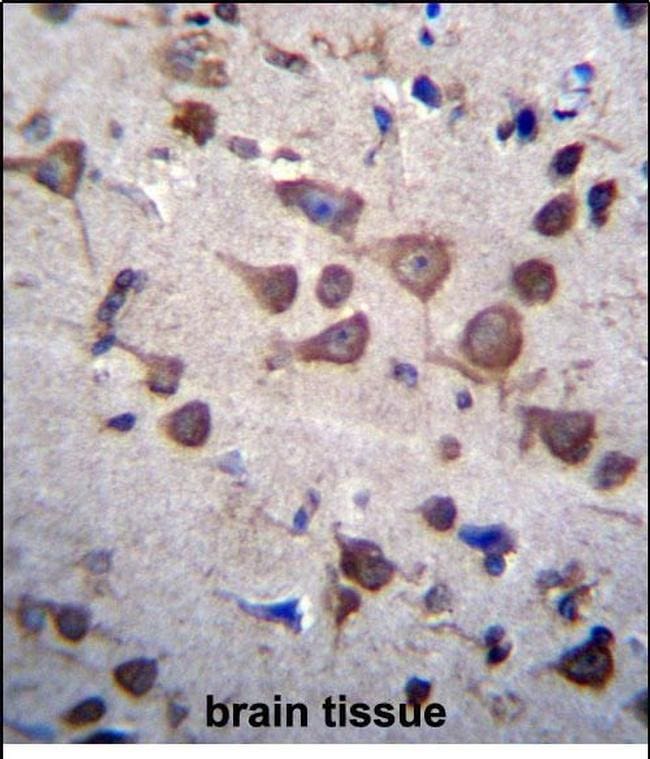 PIGA Antibody in Immunohistochemistry (Paraffin) (IHC (P))