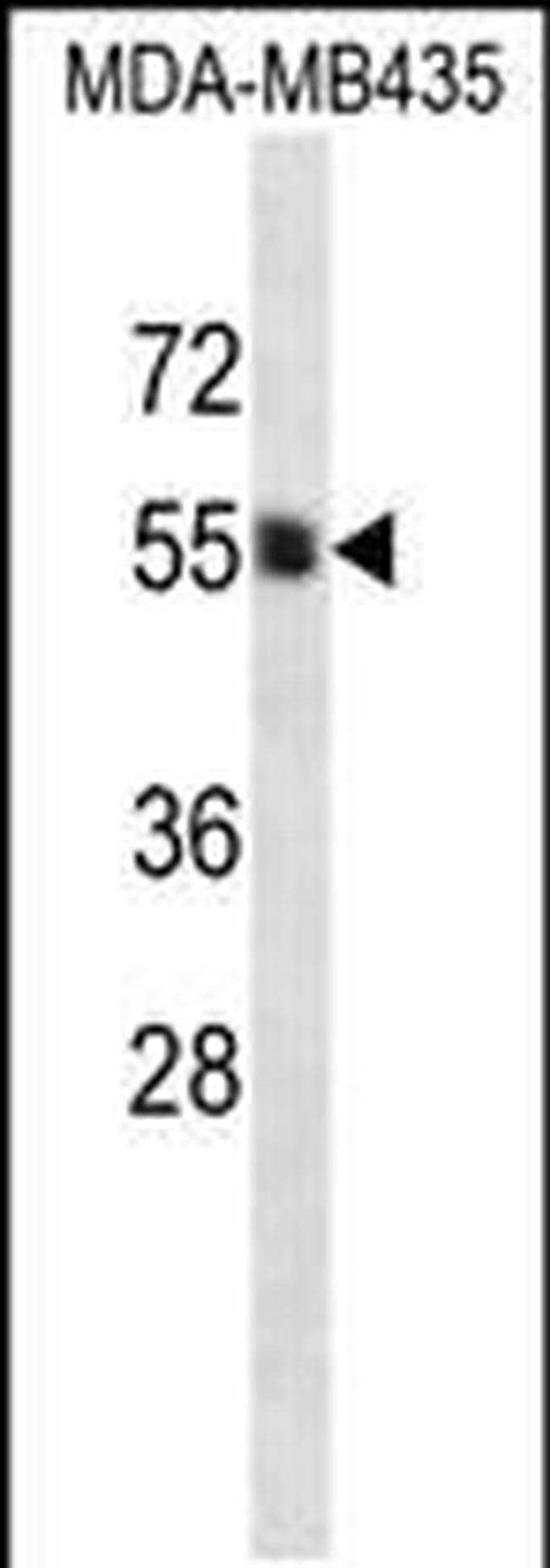 PIGA Antibody in Western Blot (WB)