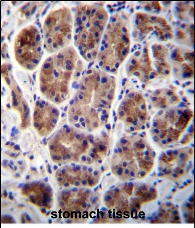 MAN2A2 Antibody in Immunohistochemistry (Paraffin) (IHC (P))