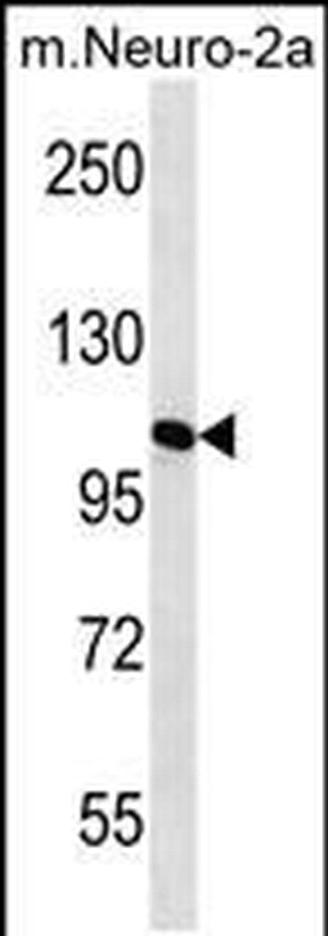 MAN2A2 Antibody in Western Blot (WB)