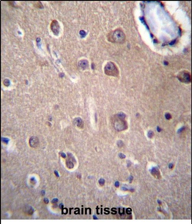 SLC8A3 Antibody in Immunohistochemistry (Paraffin) (IHC (P))