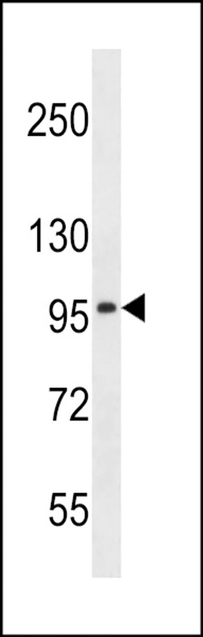 SLC8A3 Antibody in Western Blot (WB)