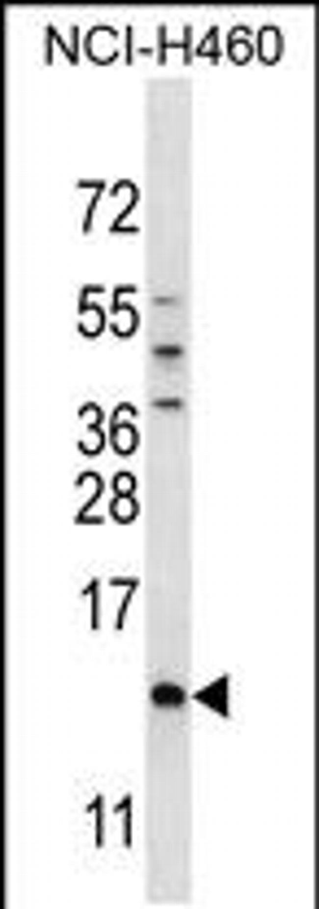 SMCP Antibody in Western Blot (WB)