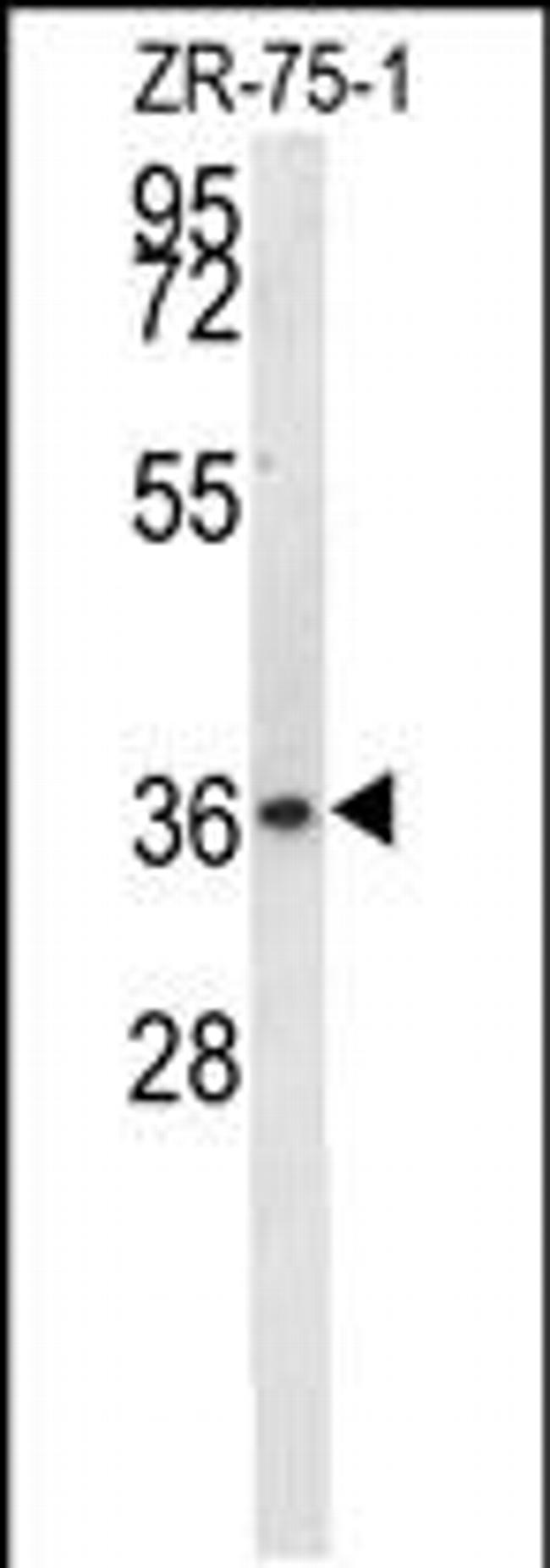 NIT1 Antibody in Western Blot (WB)