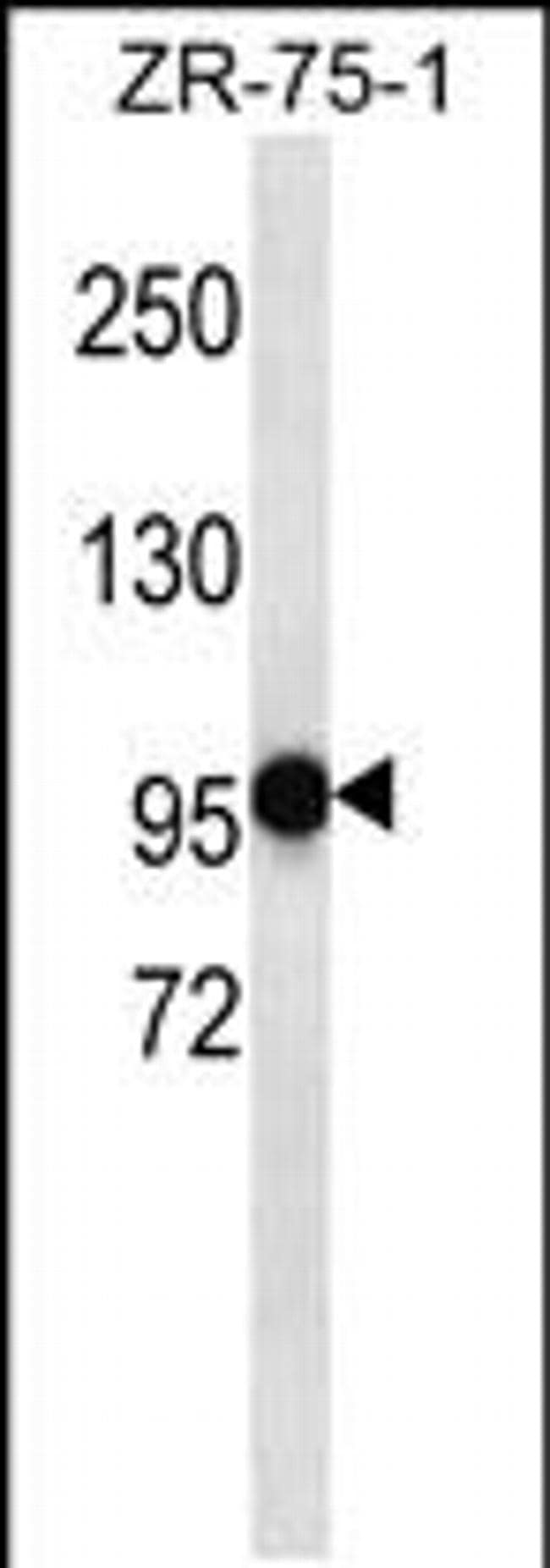 PHF14 Antibody in Western Blot (WB)