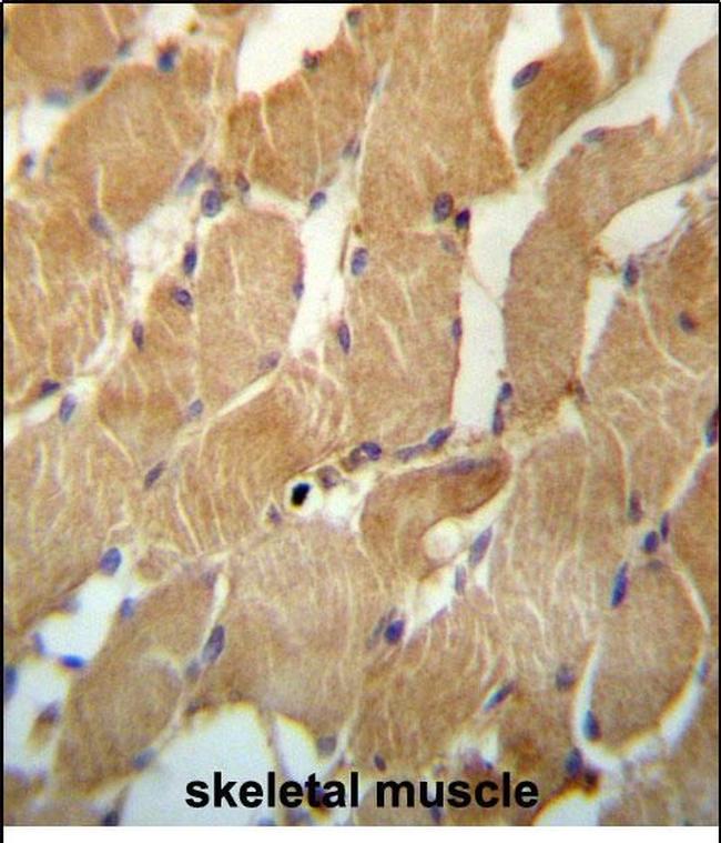 NDUFAF2 Antibody in Immunohistochemistry (Paraffin) (IHC (P))