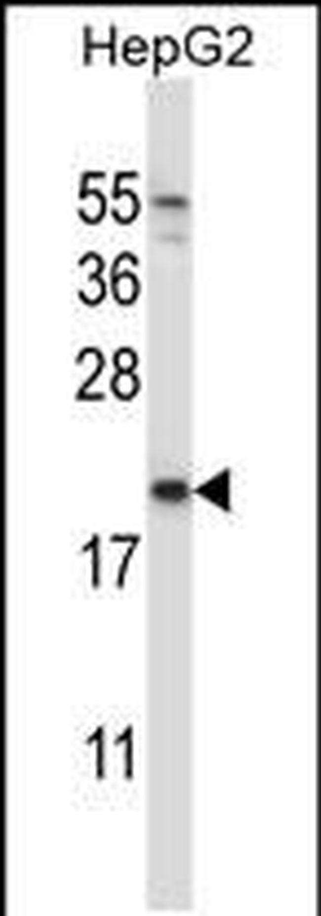 NDUFAF2 Antibody in Western Blot (WB)