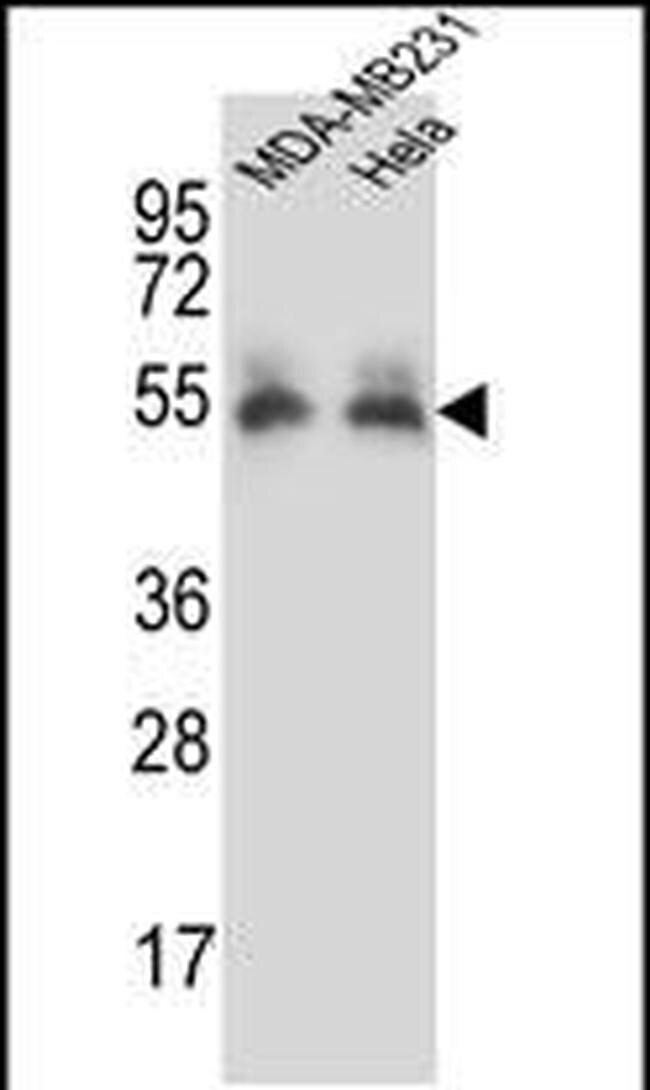 PRCP Antibody in Western Blot (WB)