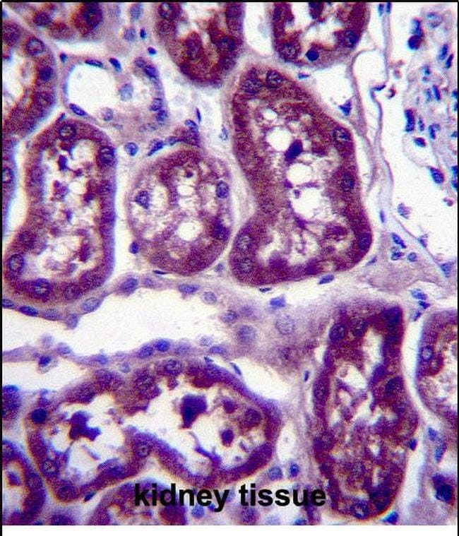 DPYS Antibody in Immunohistochemistry (Paraffin) (IHC (P))