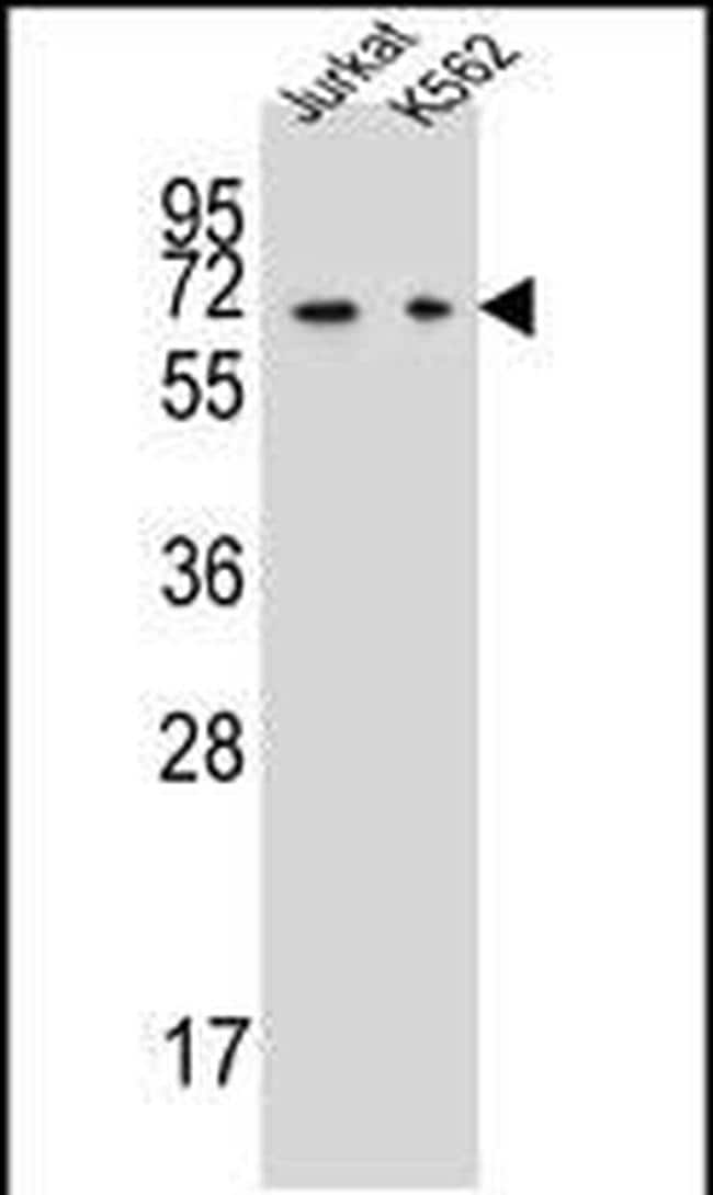 DPYS Antibody in Western Blot (WB)