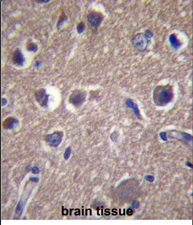 ANKS1B Antibody in Immunohistochemistry (Paraffin) (IHC (P))