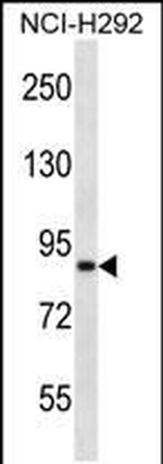 ANKS1B Antibody in Western Blot (WB)