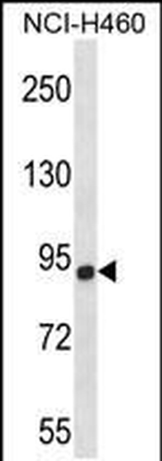 CHSY1 Antibody in Western Blot (WB)