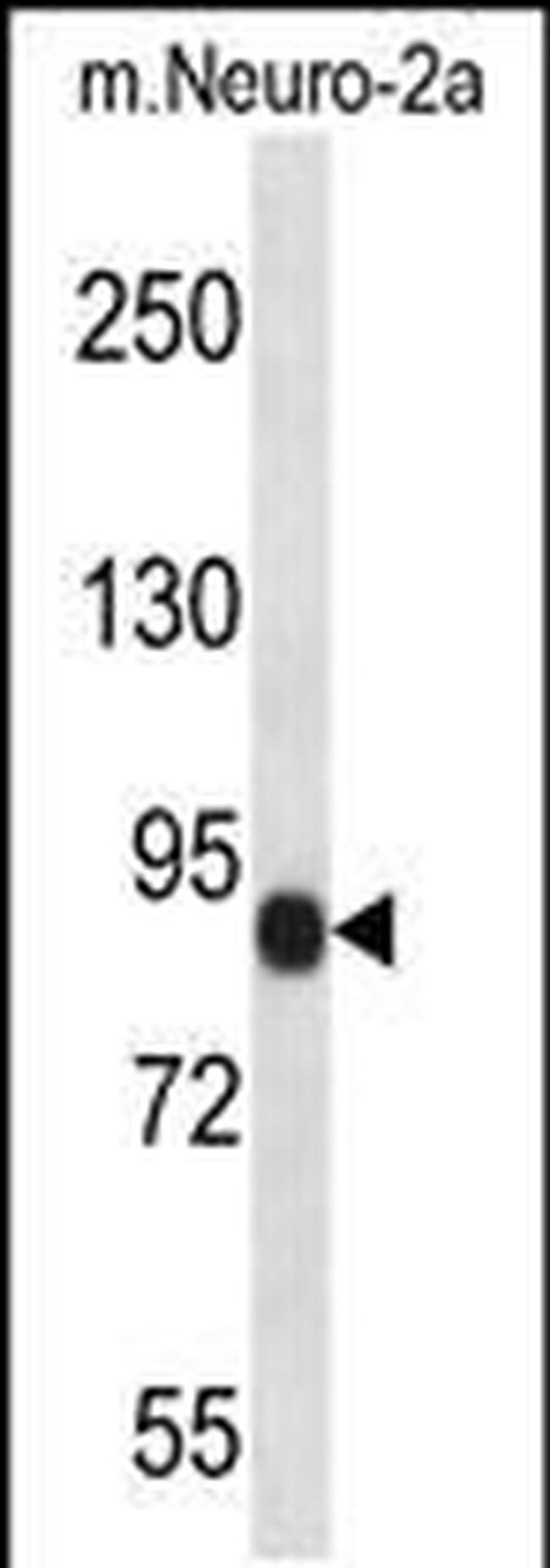 CHSY1 Antibody in Western Blot (WB)