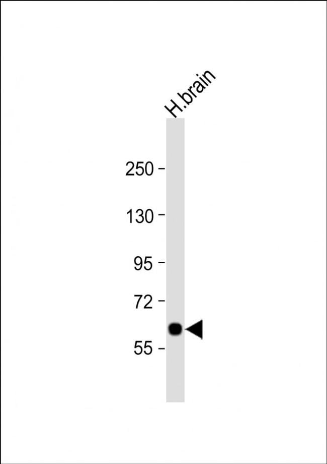 SLC2A13 Antibody in Western Blot (WB)