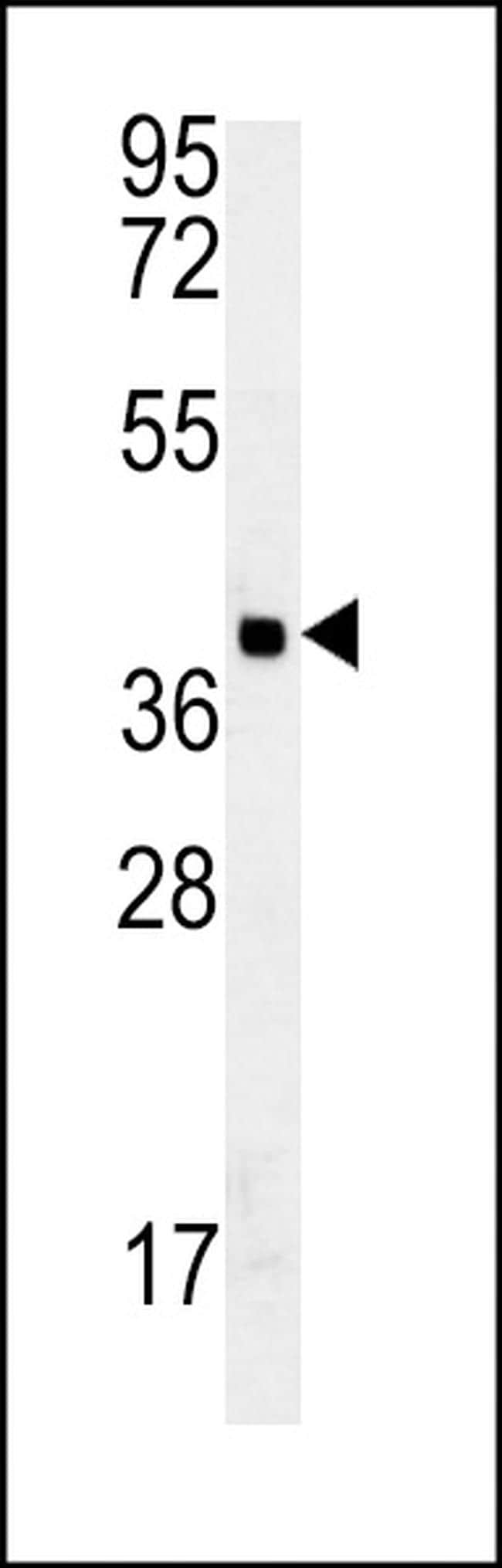 GDPD3 Antibody in Western Blot (WB)