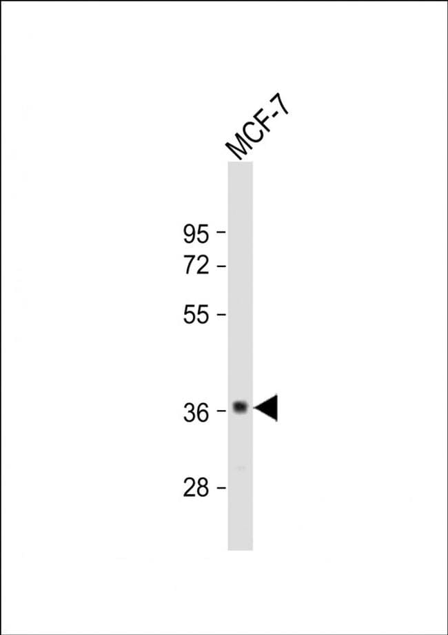 GDPD3 Antibody in Western Blot (WB)