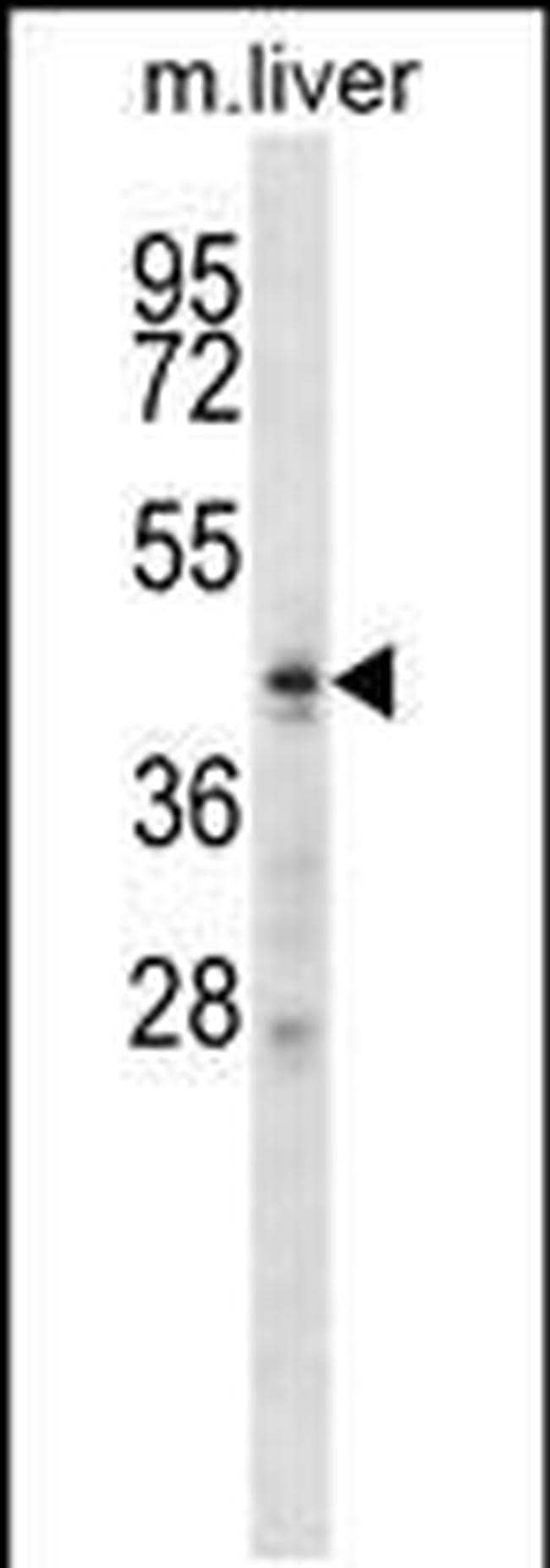 ZDHHC6 Antibody in Western Blot (WB)