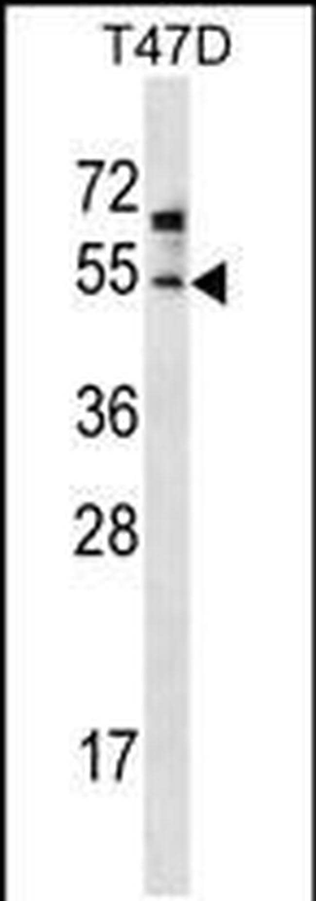 ZDHHC6 Antibody in Western Blot (WB)