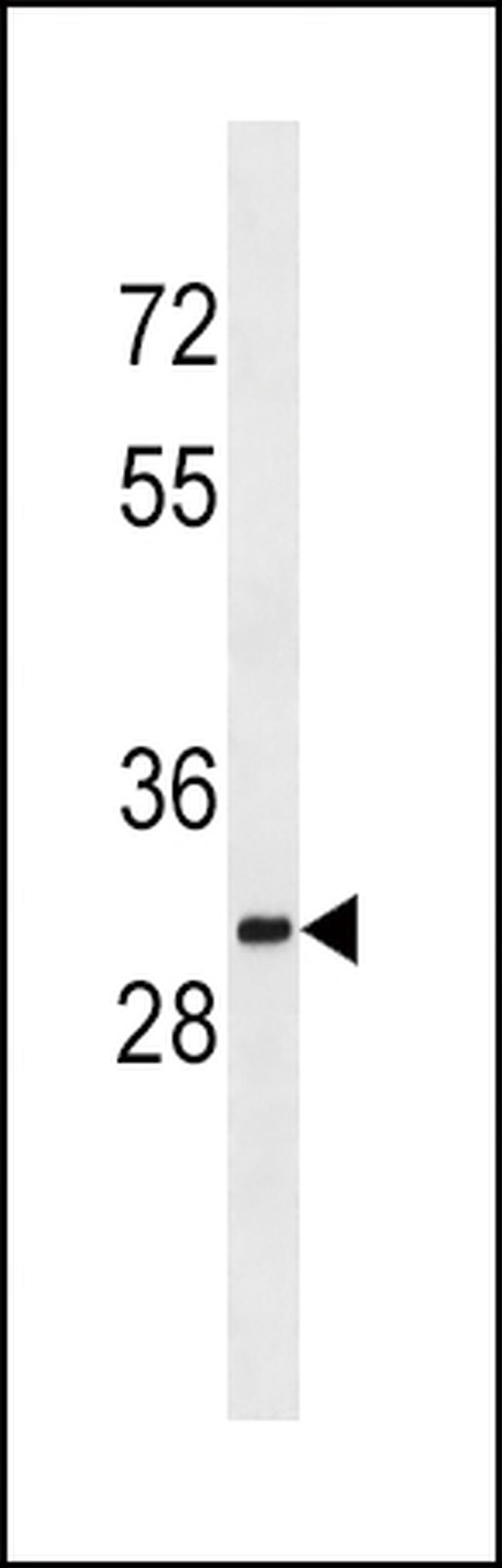 SULT1A2 Antibody in Western Blot (WB)