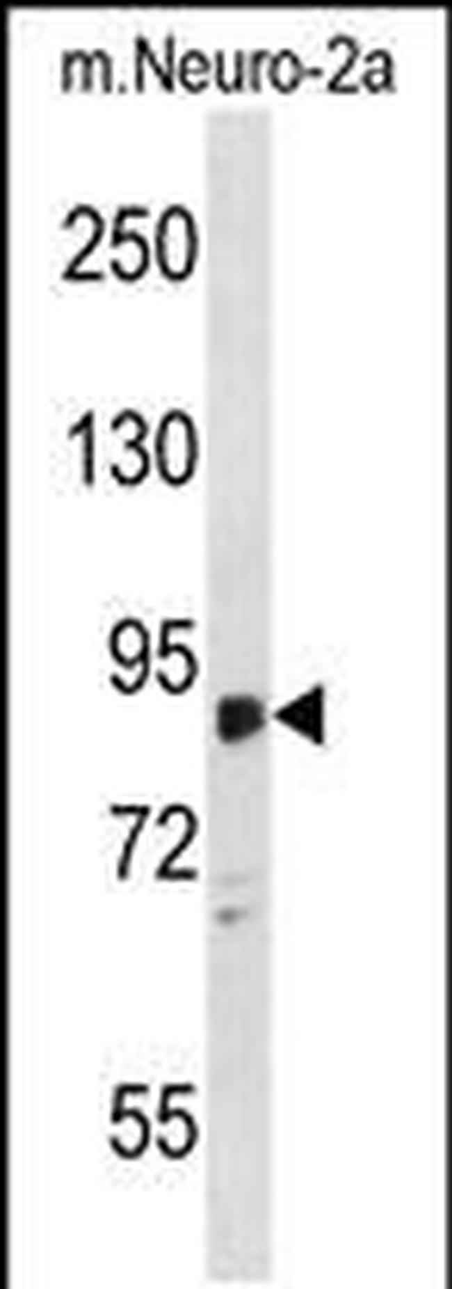 ZDHHC8 Antibody in Western Blot (WB)