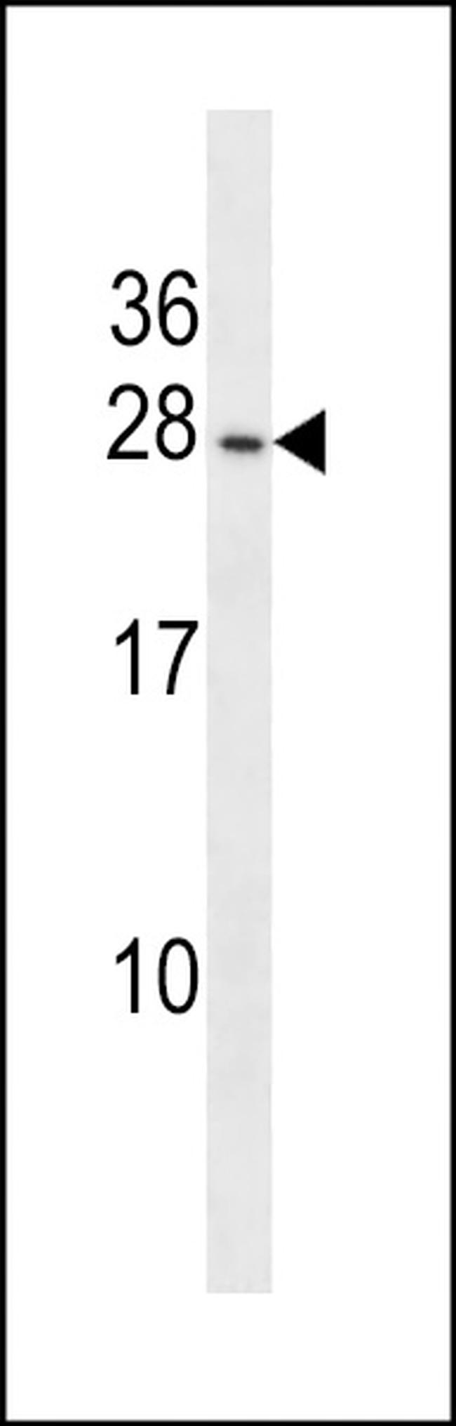 PIGP Antibody in Western Blot (WB)