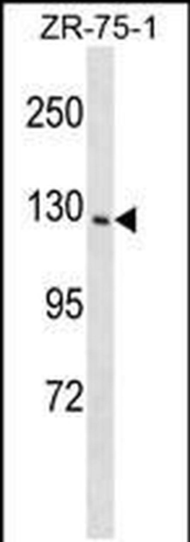 PITPNM1 Antibody in Western Blot (WB)