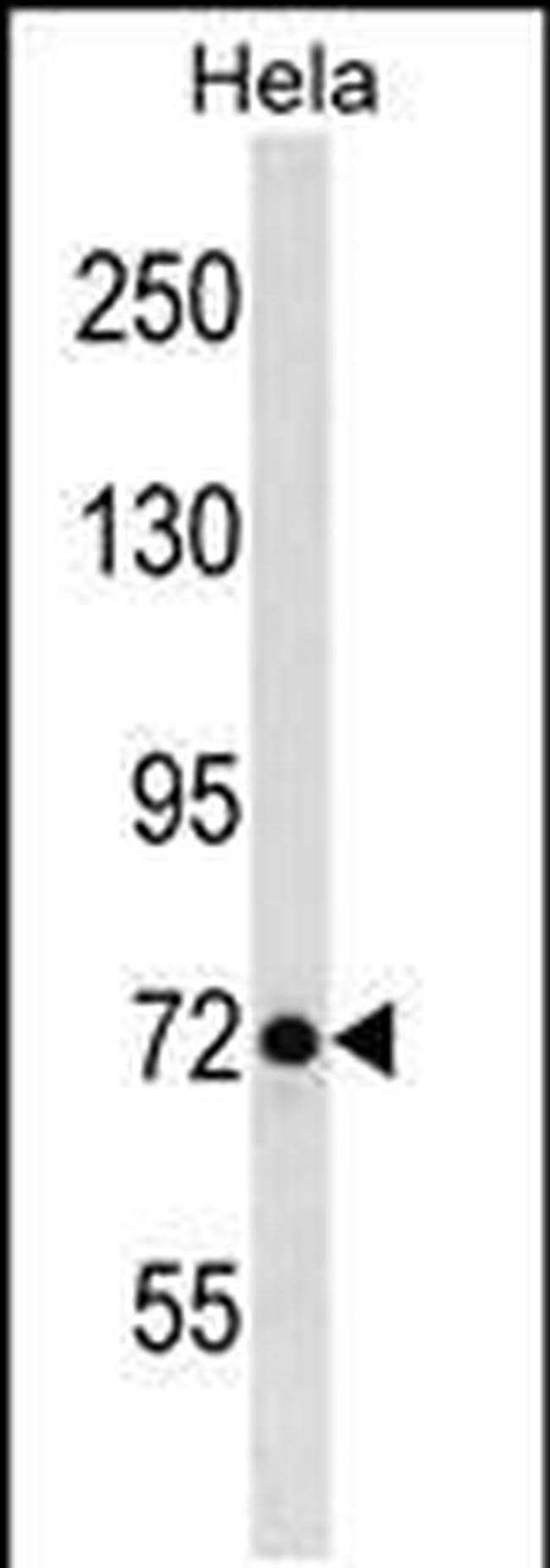 LAS1L Antibody in Western Blot (WB)