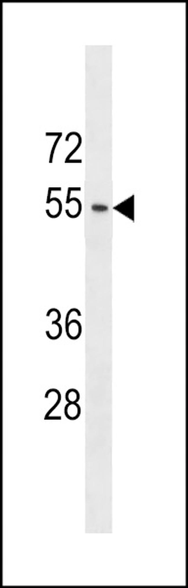 ACTL9 Antibody in Western Blot (WB)